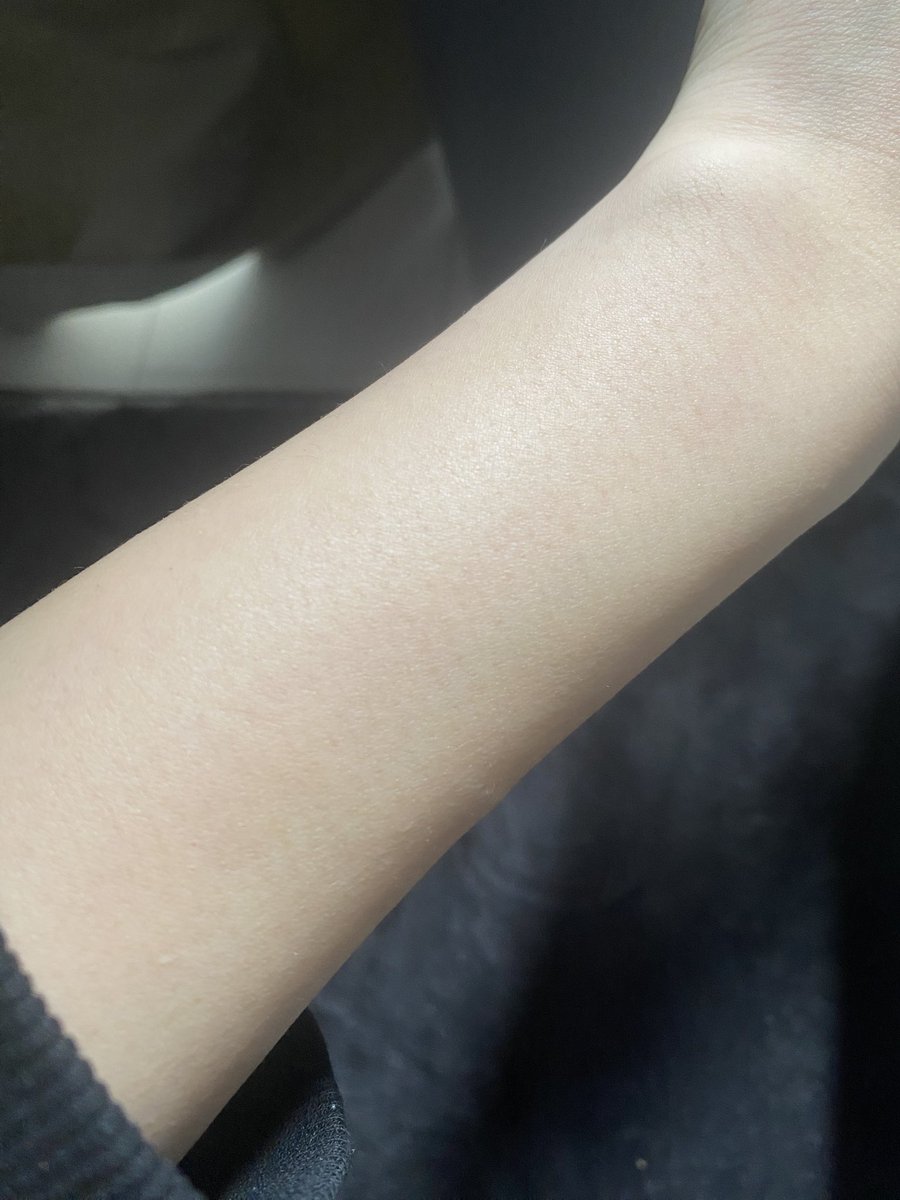 geme_noa's tweet photo. 1年以上剃ってないリアルなわたしの腕(笑)
ジェントルマックスプロはめちゃくちゃおすすめです https://t.co/nWnwJqnvlH