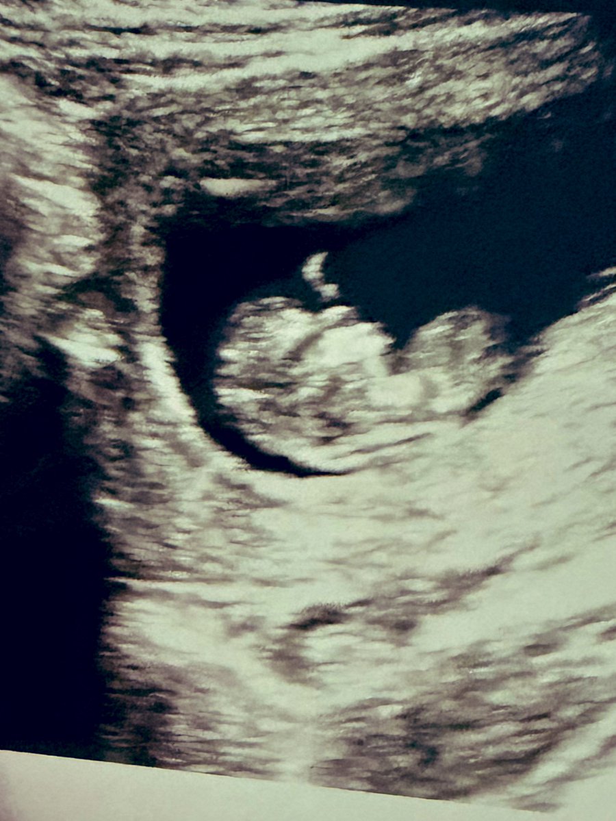 OxyAres (Jake) tweet media