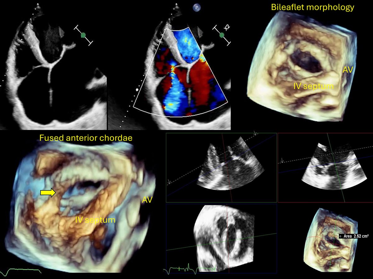 Reviews in Cardiovascular Medicine tweet media