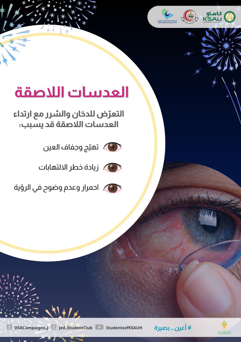 DSACampaigns_J's tweet photo. ⚠️ انتبه! 
الدخان والشرر مع العدسات = تهيّج والتهابات

#أعين_بصيرة https://t.co/82FSHgXHu0