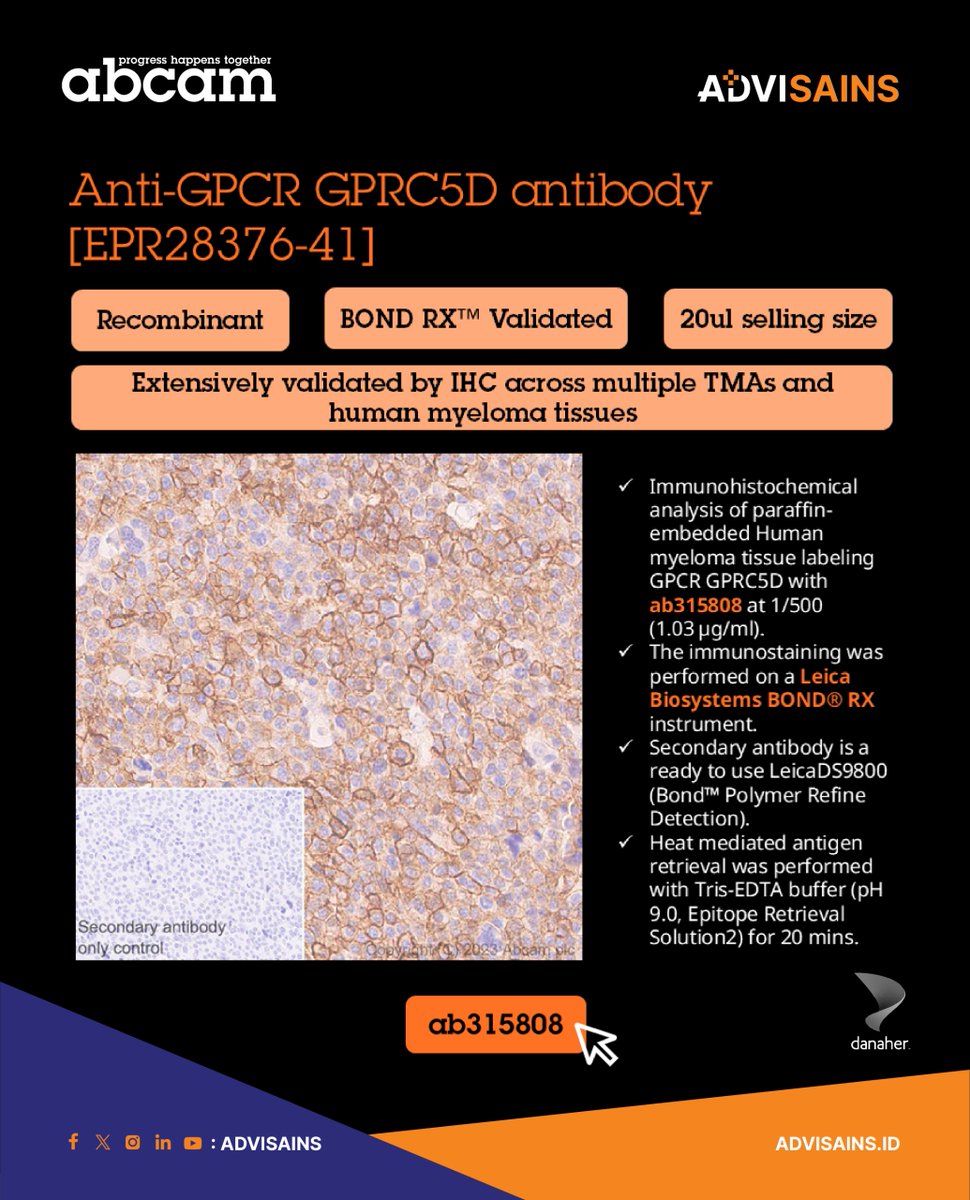 advisains's tweet image. 🔥 New: GPRC5D antibody [EPR2837641] (ab315808). 
✅Recombinant Antibody
✅IHC on TMAs &amp;amp; myeloma
✅Leica BOND® RXvalidated
✅reliable supply
See data: go to Abcam and search “ab315808.”
#GPRC5D #IHC #RecombinantAntibody