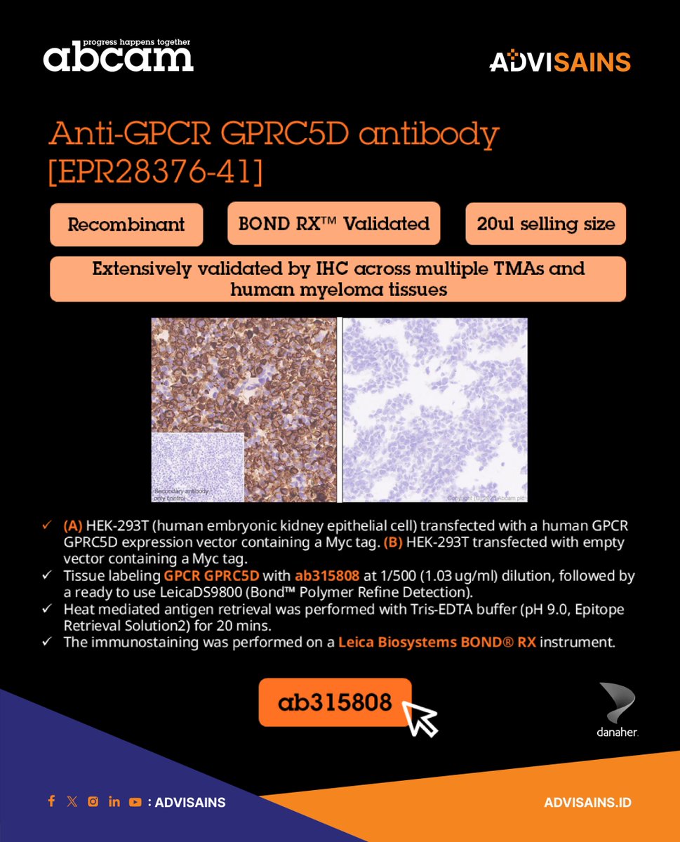advisains's tweet image. 🔥 New: GPRC5D antibody [EPR2837641] (ab315808). 
✅Recombinant Antibody
✅IHC on TMAs &amp;amp; myeloma
✅Leica BOND® RXvalidated
✅reliable supply
See data: go to Abcam and search “ab315808.”
#GPRC5D #IHC #RecombinantAntibody