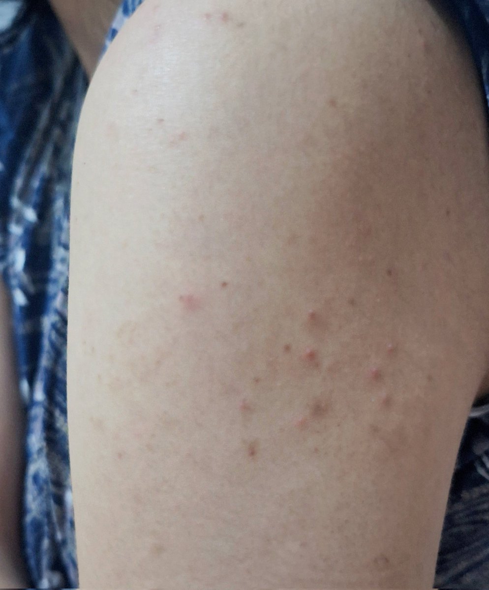 Olivia ★ tweet media