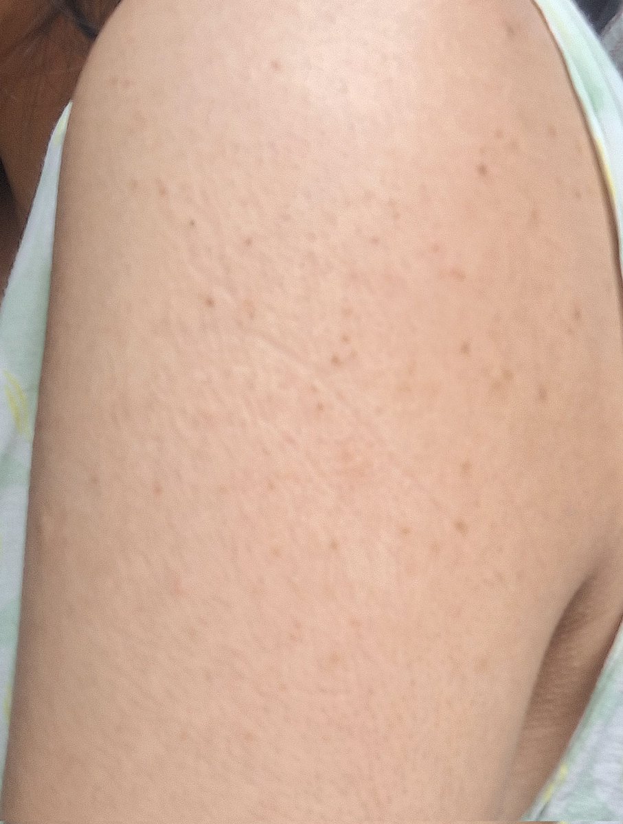 Olivia ★ tweet media