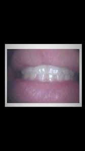 Megamush tweet media