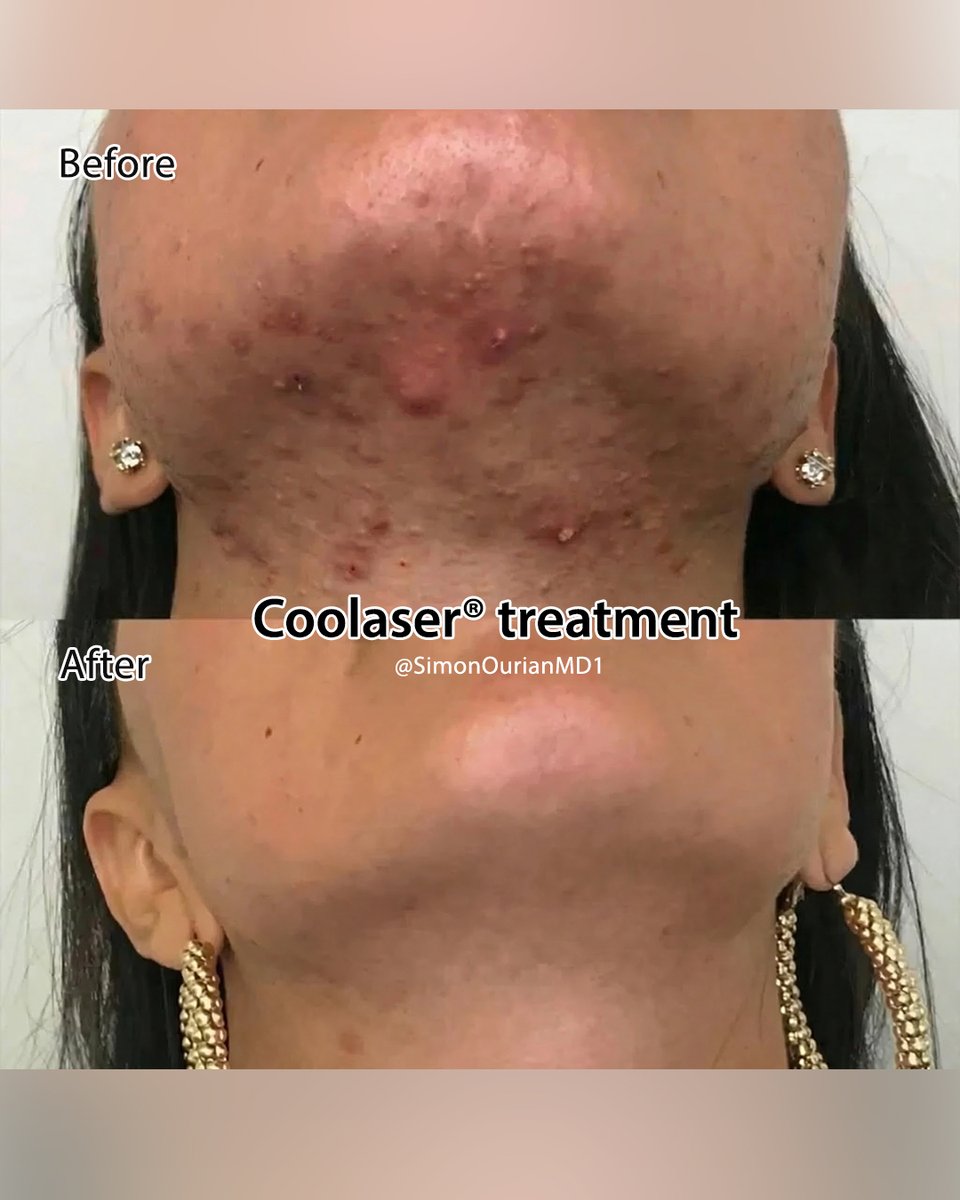 Dr. Simon Ourian - Epione tweet media