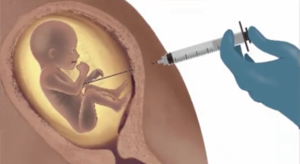 If you have an abortion very late in pregnancy.

I’m treating you the same as if you have just ended the life of your newborn.

CRIMINAL.