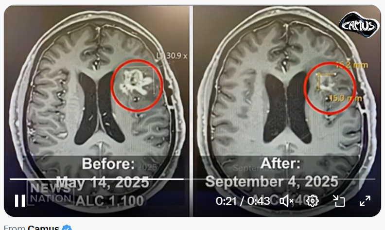 Dr. Thomas Ichim tweet media