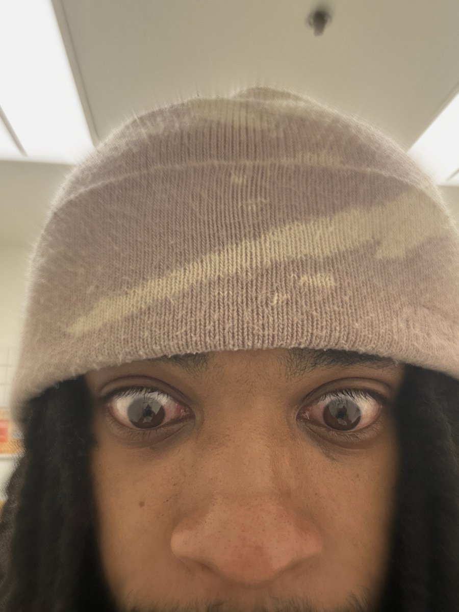 ongomaan's tweet photo. 😳 https://t.co/SkzRo5YtXd