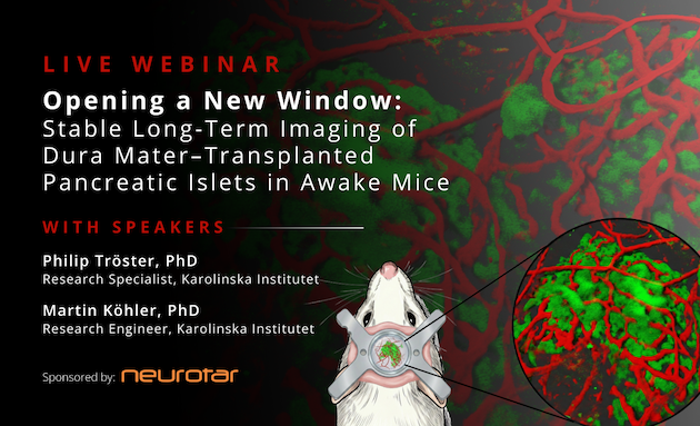 Neurotar_team's tweet photo. Watch pancreatic islets integrate and function #invivo!
Join Tröster &amp; Köhler (@karolinskainst) on March 26 and learn how to image β-cells longitudinally using the brain as a medium.

Webinar: https://t.co/yl63lYBNSR

#Neuroscience #CalciumImaging #Organoids #diabetestype2 https://t.co/vCU0nHHH0X