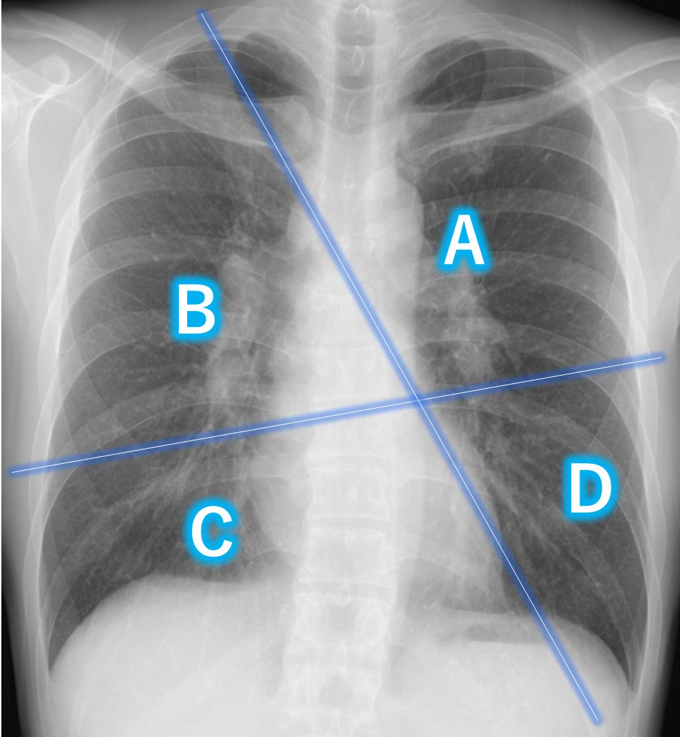 lung-dr | 呼吸器内科医 tweet media