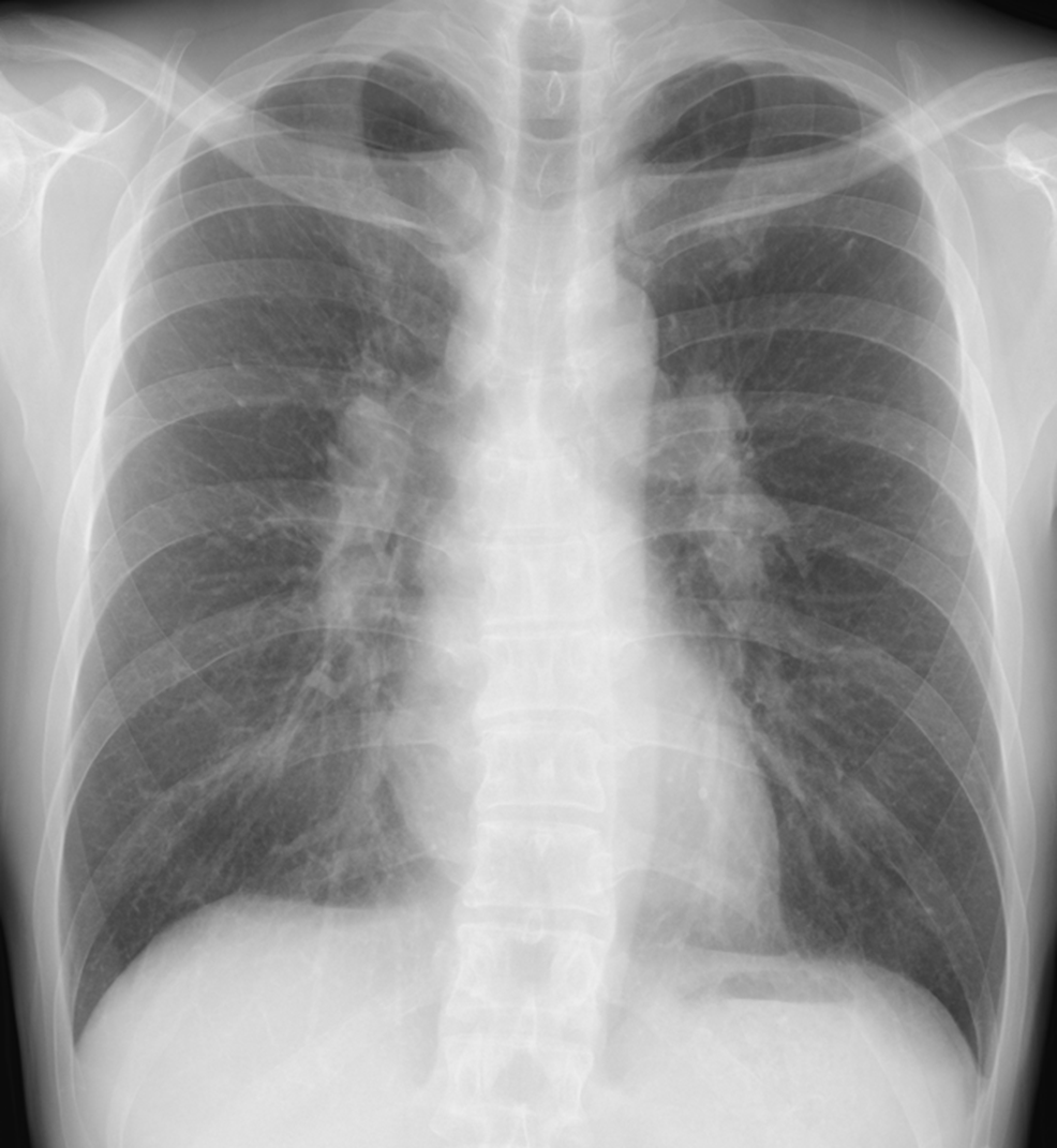 lung-dr | 呼吸器内科医 tweet media