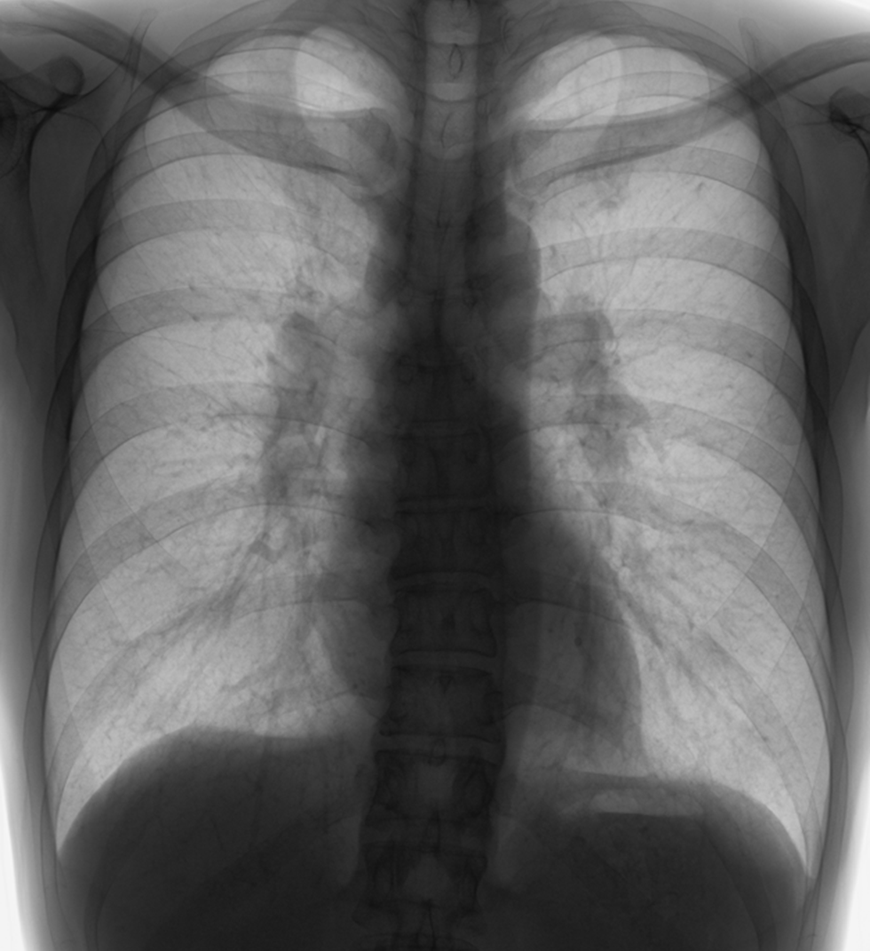 lung-dr | 呼吸器内科医 tweet media