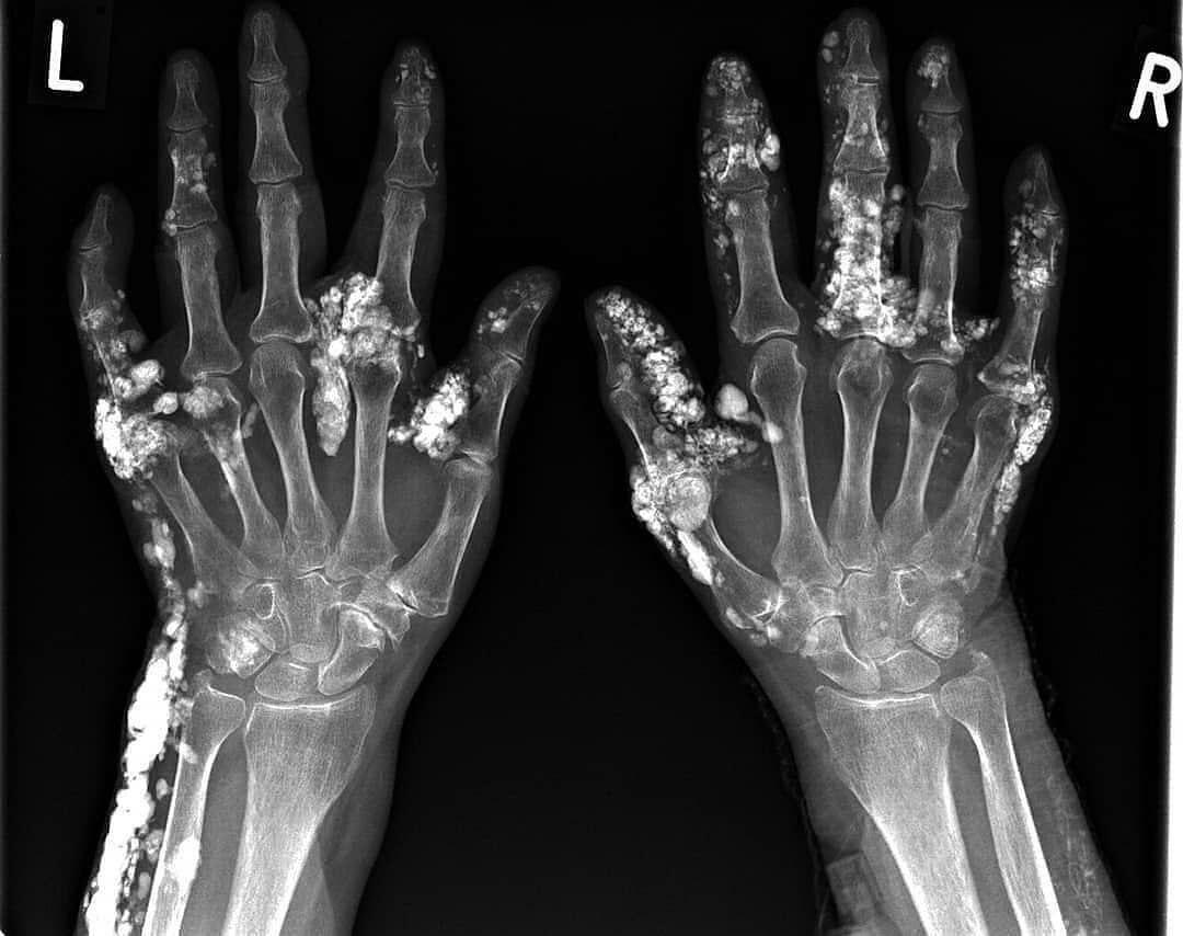 Dr Ihab Suliman tweet media