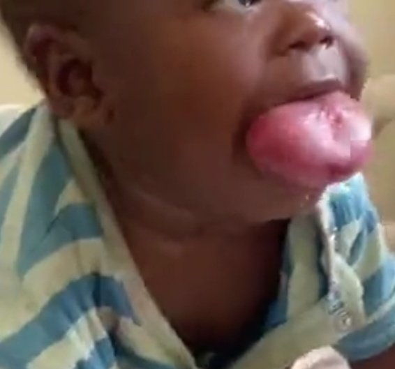 Dr Ihab Suliman tweet media