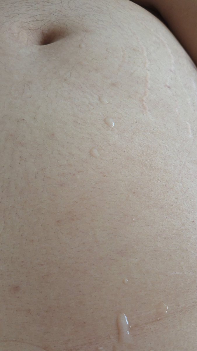 短毛的瑞(🐷)在成都 tweet media