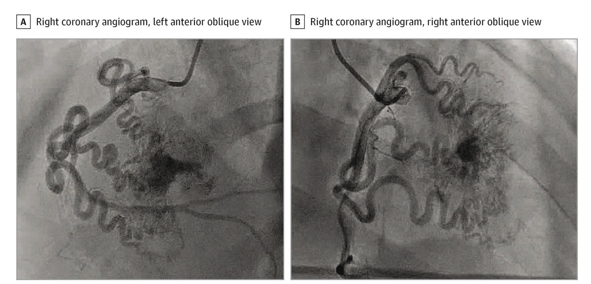 JAMA Cardiology tweet media