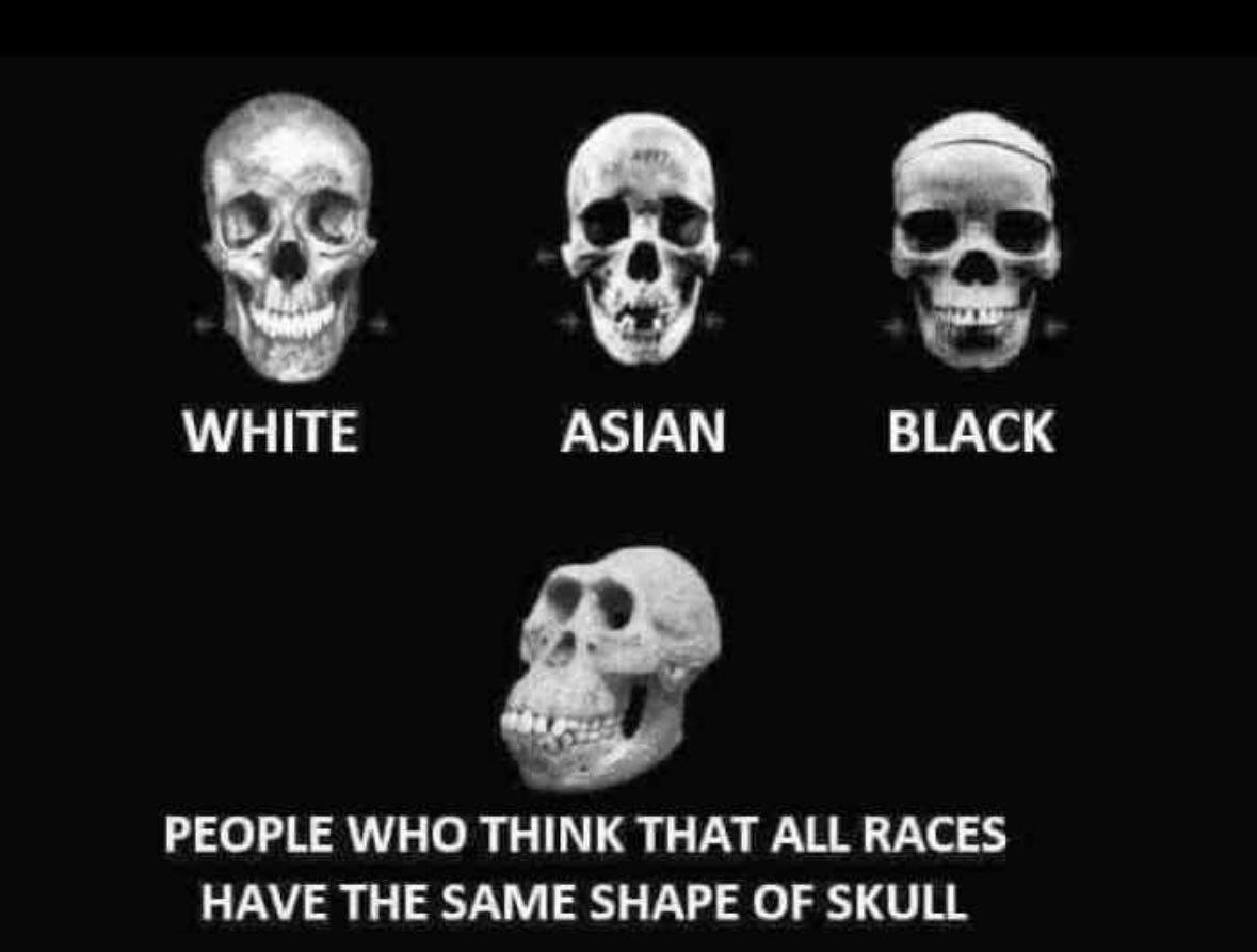 Far right Rob 🏴󠁧󠁢󠁥󠁮󠁧󠁿 tweet media