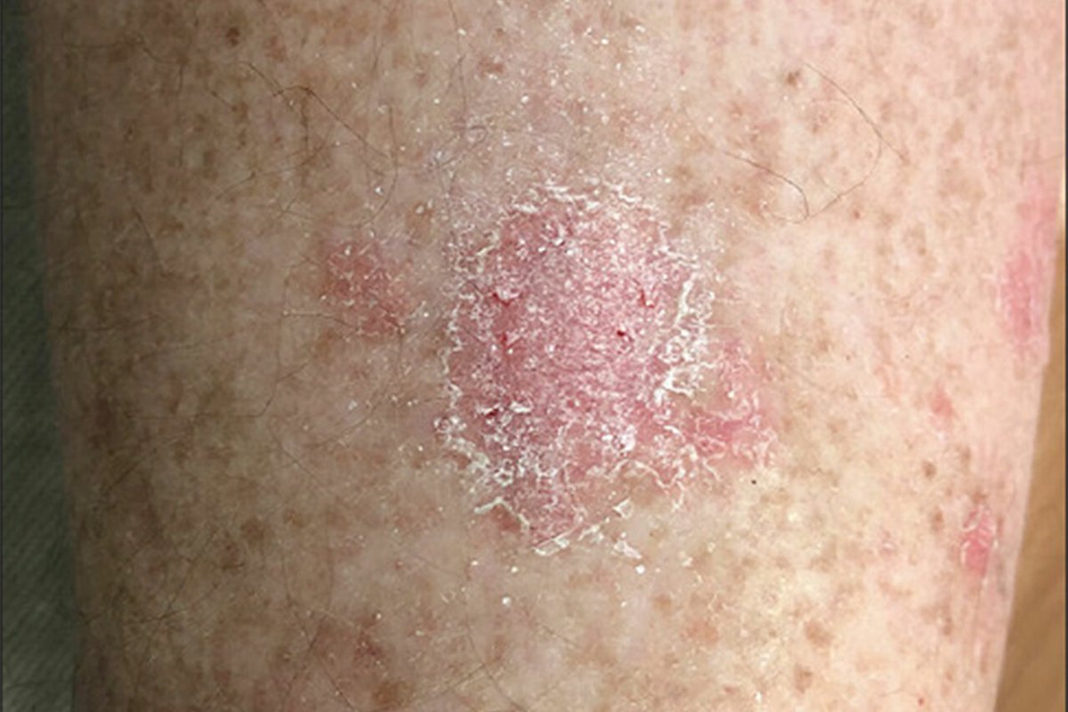 Dr Abdul Hameed 🩺 tweet media