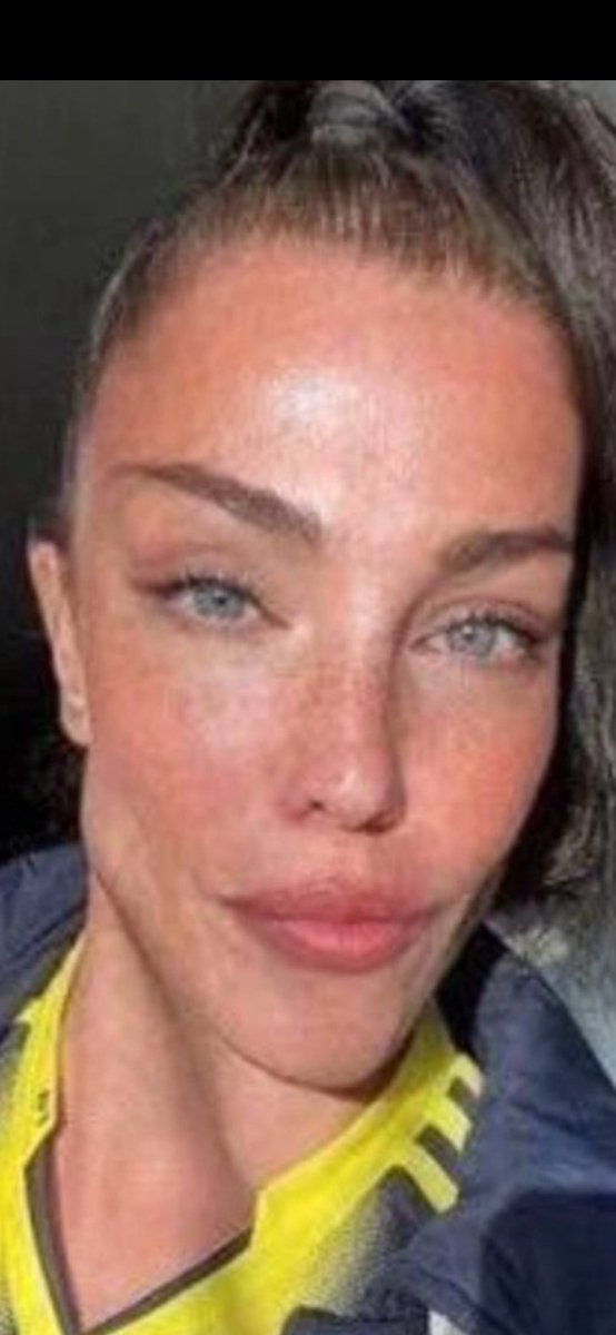 Boey1905 🇩🇪 tweet media