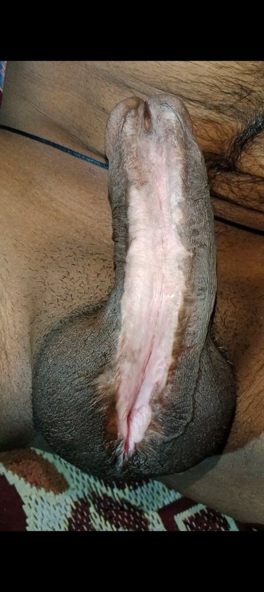 @monster subincision tweet media