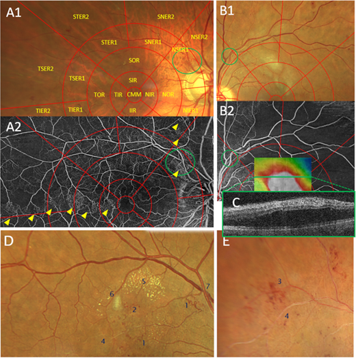 IOVS Journal tweet media