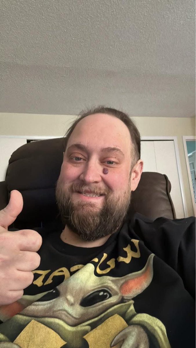 Scratch Point tweet media