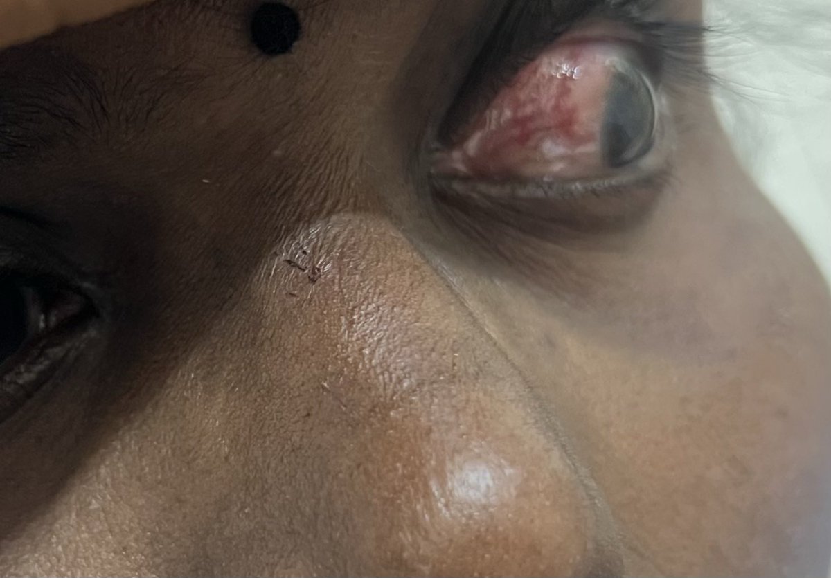 ILLIASUL IBAD tweet media