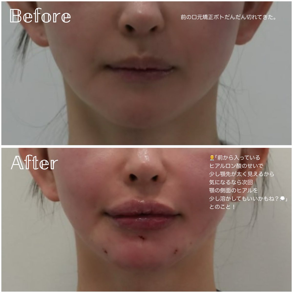 𝐲̆̈子ちゃん tweet media