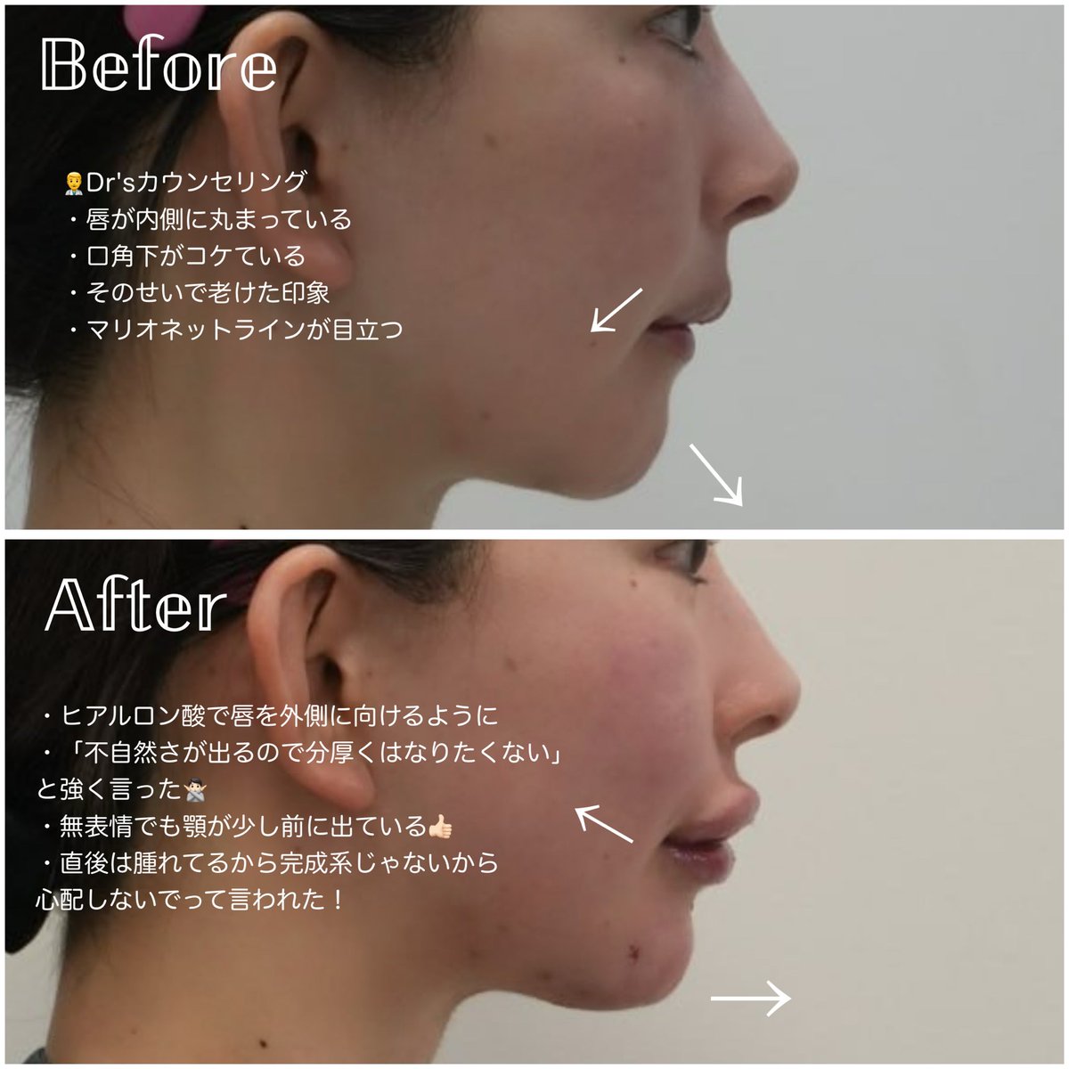 𝐲̆̈子ちゃん tweet media