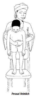 AldhitamaR's tweet photo. Memposisikan anak tersedak dibedakan berdasarkan usia. 

Untuk bayi (<1 tahun): tengkurapkan di lengan/paha (kepala lebih rendah) untuk back blows (pukul punggung) atau telentang untuk chest thrust (tekan dada). 

Untuk anak (>1 tahun): peluk dari belakang (posisi berdiri/duduk) untuk abdominal thrust(hentakan perut/Heimlich manuver).

Harus adekuat ya, gausah takut takut.

Jangan pernah melakukan blind finger sweep (memasukkan jari ke mulut tanpa melihat objek) karena bisa mendorong benda lebih dalam.

Jika anak masih bisa batuk kuat, biarkan dia batuk dan jangan lakukan manuver apa pun.

Segera cari pertolongan medis jika anak pingsan atau benda asing tidak kunjung keluar.