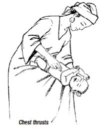 AldhitamaR's tweet photo. Memposisikan anak tersedak dibedakan berdasarkan usia. 

Untuk bayi (<1 tahun): tengkurapkan di lengan/paha (kepala lebih rendah) untuk back blows (pukul punggung) atau telentang untuk chest thrust (tekan dada). 

Untuk anak (>1 tahun): peluk dari belakang (posisi berdiri/duduk) untuk abdominal thrust(hentakan perut/Heimlich manuver).

Harus adekuat ya, gausah takut takut.

Jangan pernah melakukan blind finger sweep (memasukkan jari ke mulut tanpa melihat objek) karena bisa mendorong benda lebih dalam.

Jika anak masih bisa batuk kuat, biarkan dia batuk dan jangan lakukan manuver apa pun.

Segera cari pertolongan medis jika anak pingsan atau benda asing tidak kunjung keluar.