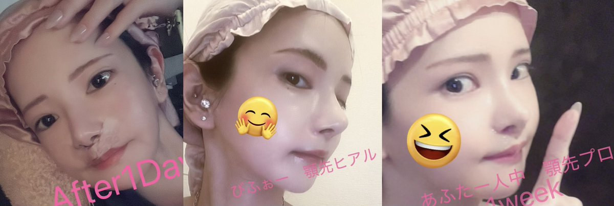 整形ずんだもん tweet media