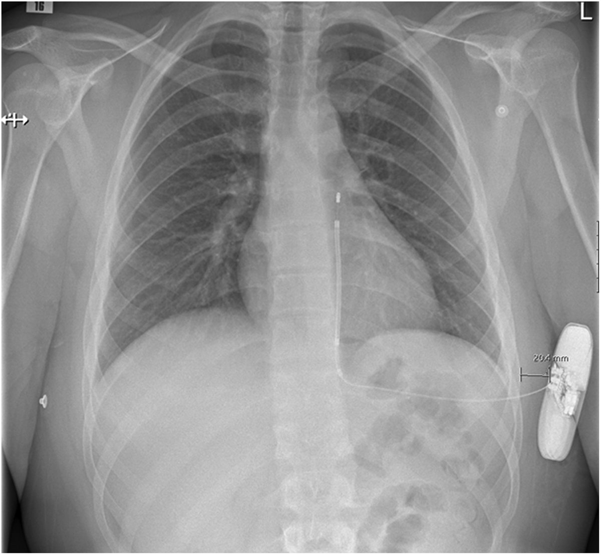 European Society of Cardiology Journals tweet media