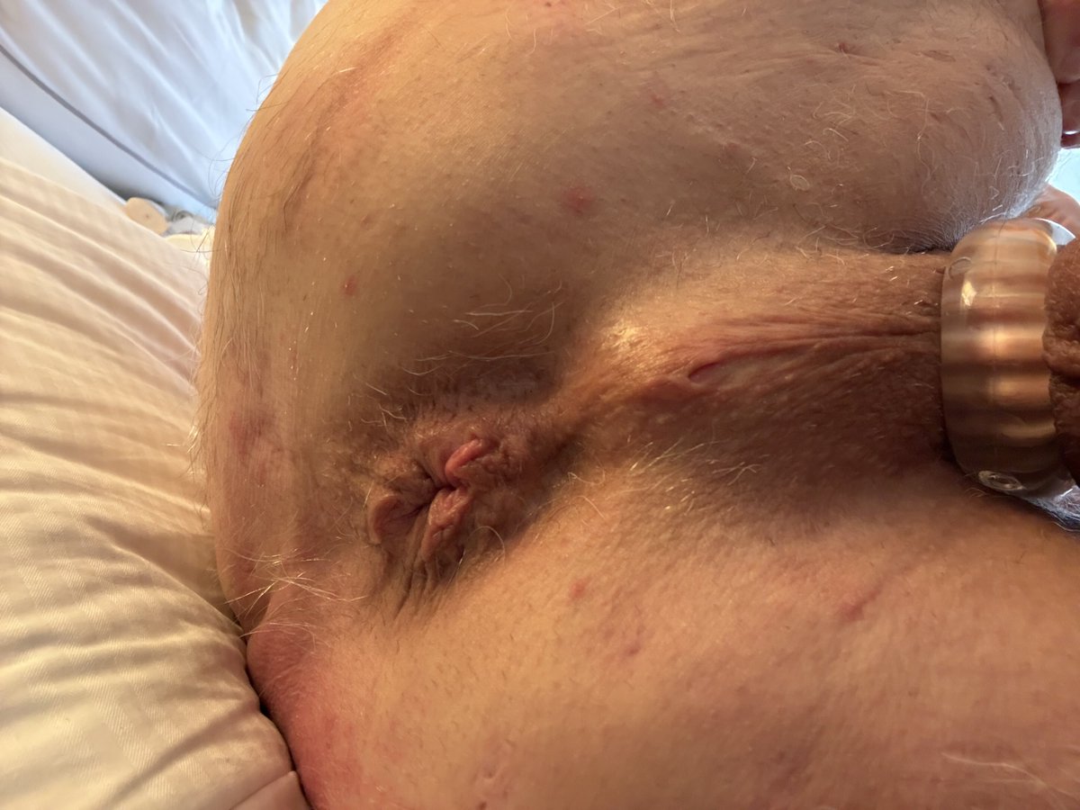 Mark Ross tweet media