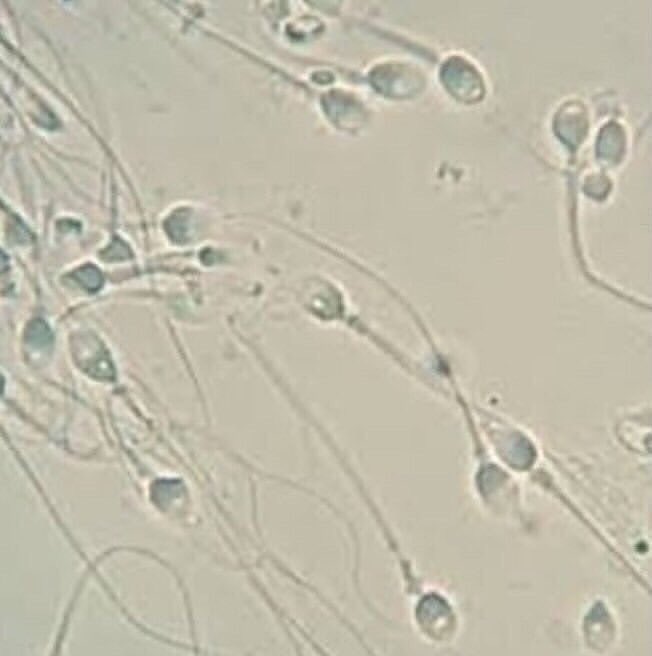 草莓🍓女の子 tweet media