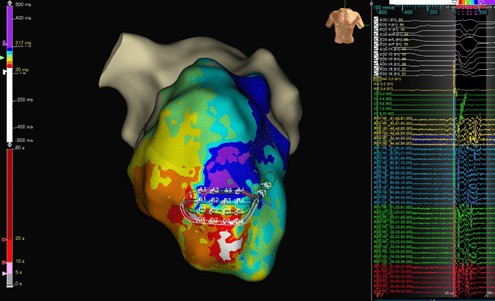 Cardiac Physiology in Practice tweet media