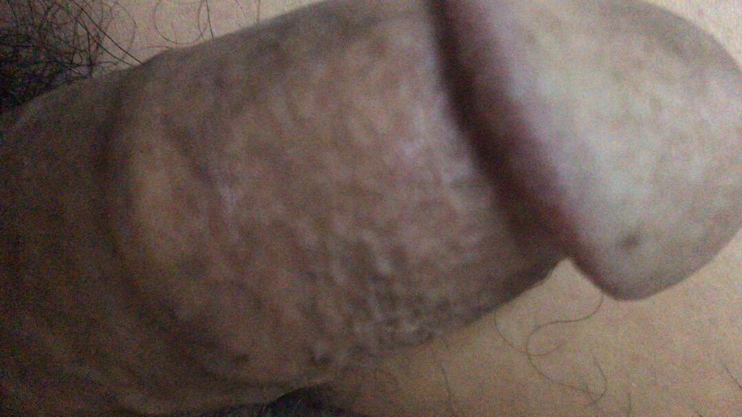 Aren Bolin tweet media