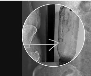विनय पंडित tweet media