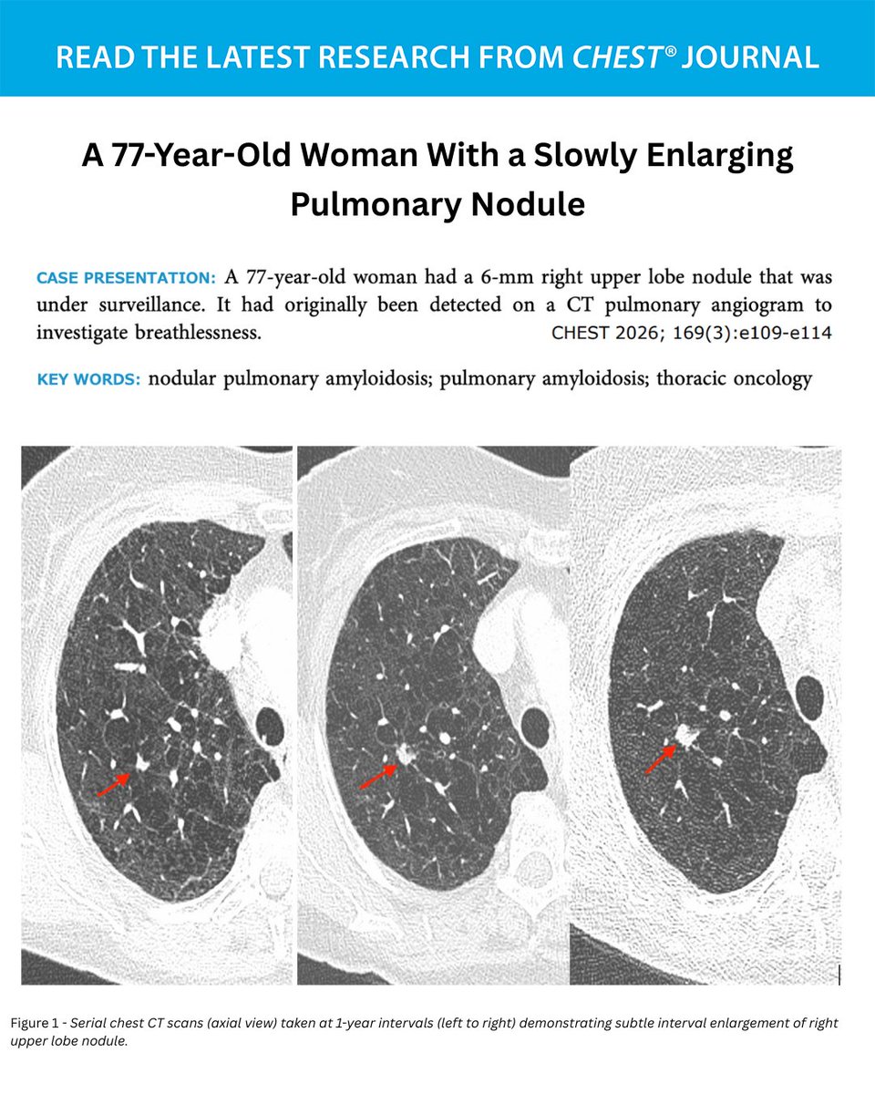 CHEST® Journal tweet media