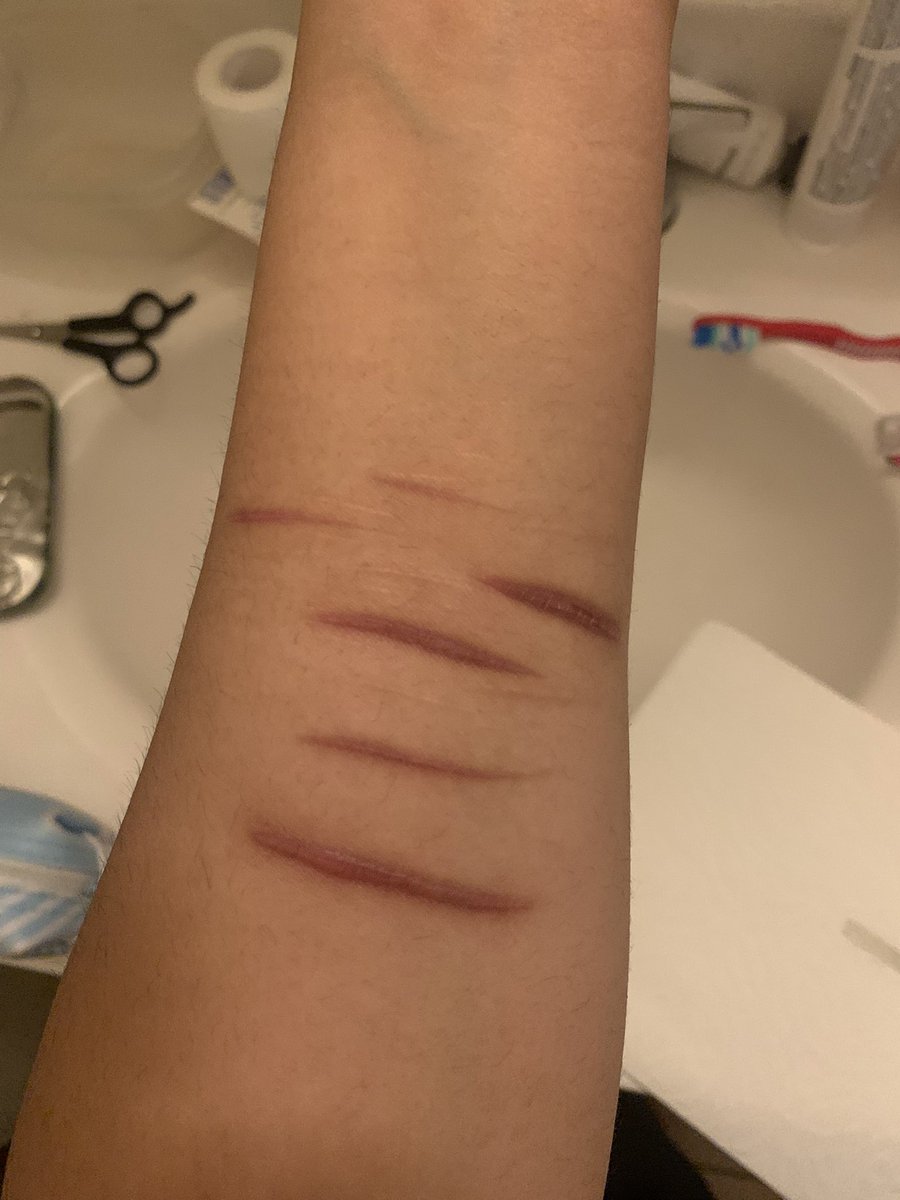 siamesedoe's tweet photo. before &amp; after todays relapse holyshit idk why i’m so nauseous! imgonna cry wtf
#shtwt #slittwt https://t.co/Sd0nSl04bD