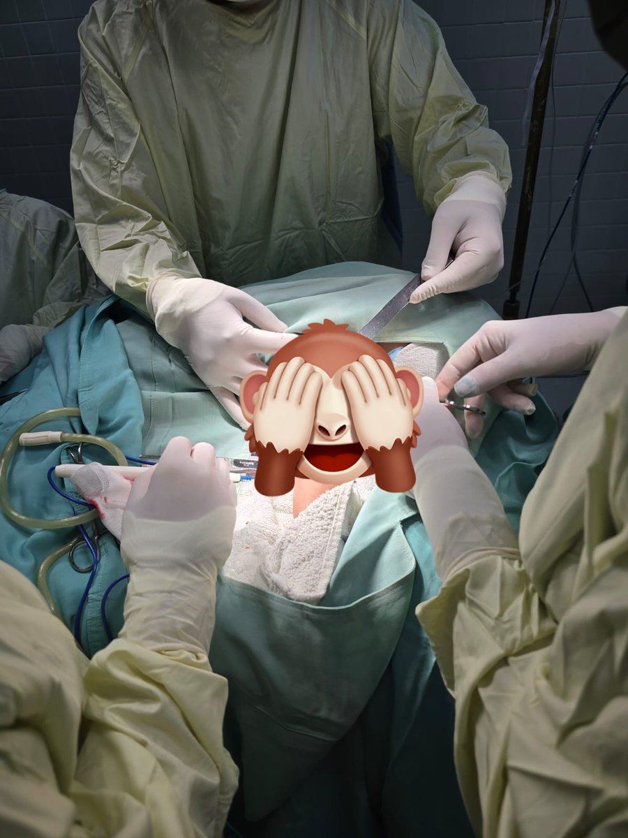 Otra vida salvada por la Dra. Kirenia, Se opera lactante de 10 meses de edad con malfornacion vascular en brazo izquierdo #CubaCoopera