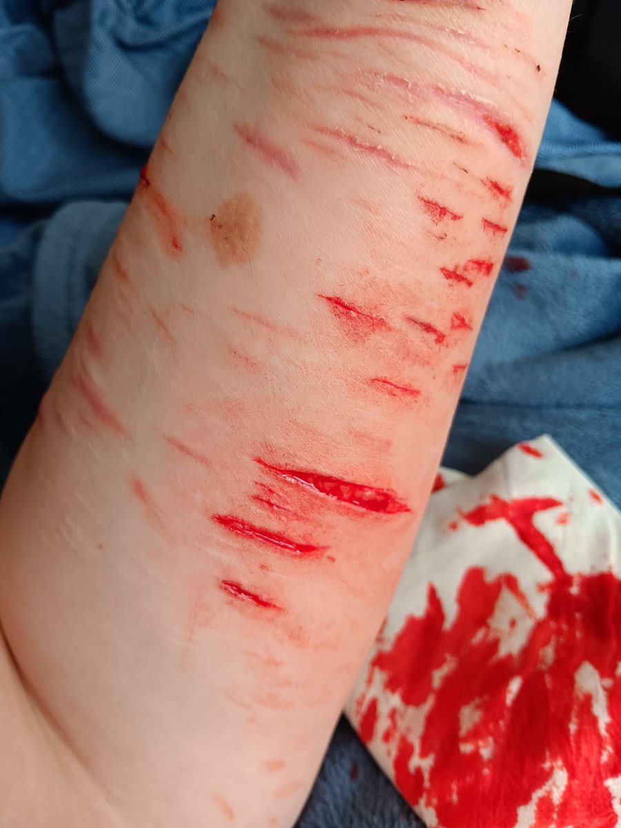 ୨ 🐇 ୧﹔ anika︐ semi active tweet media