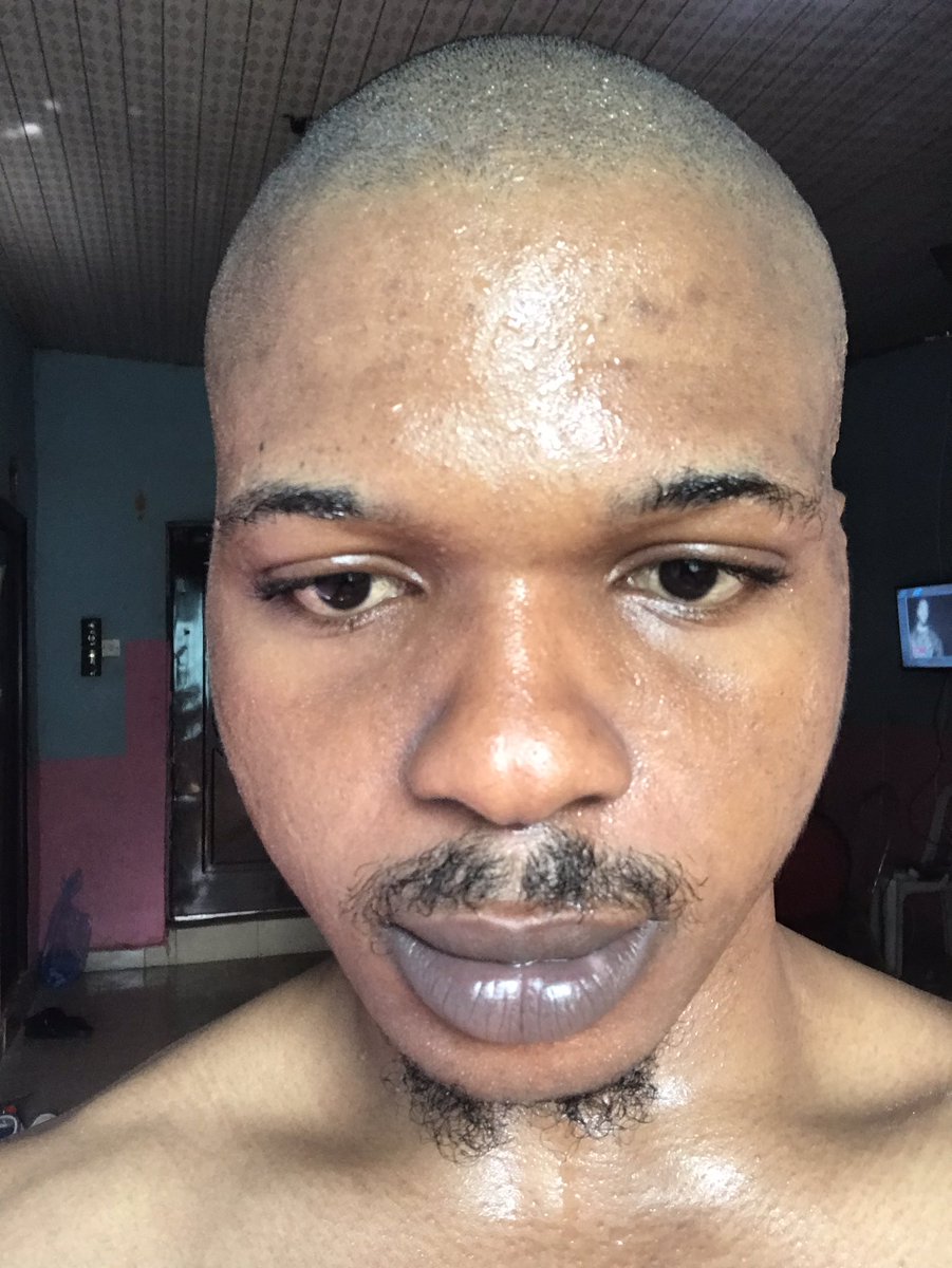 🎖KODEAD🎖 tweet media