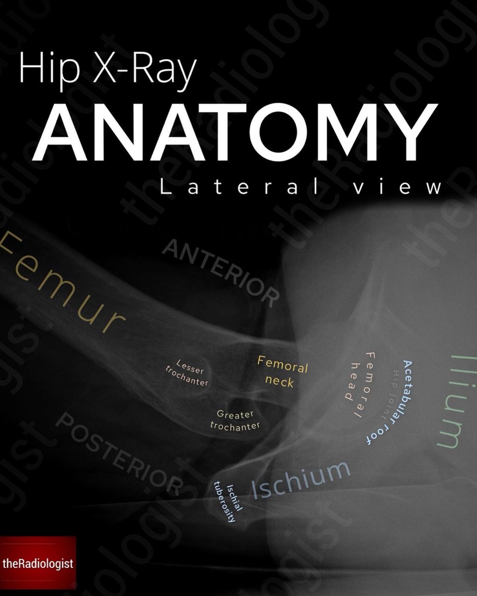 radiologistpage's tweet photo. Pelvic X-Ray anatomy https://t.co/WDeOLXp4S6