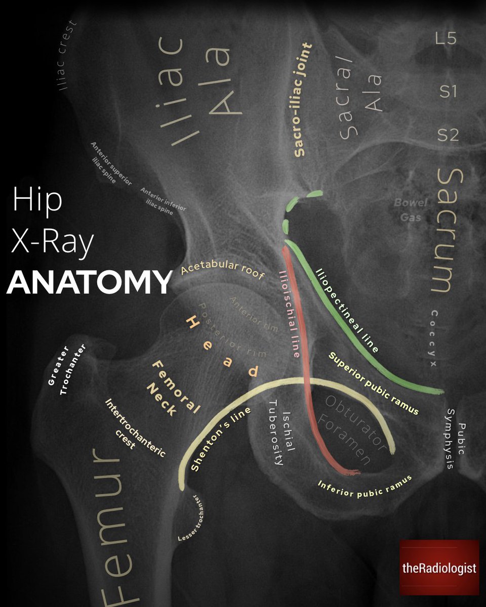 Pelvic X-Ray anatomy