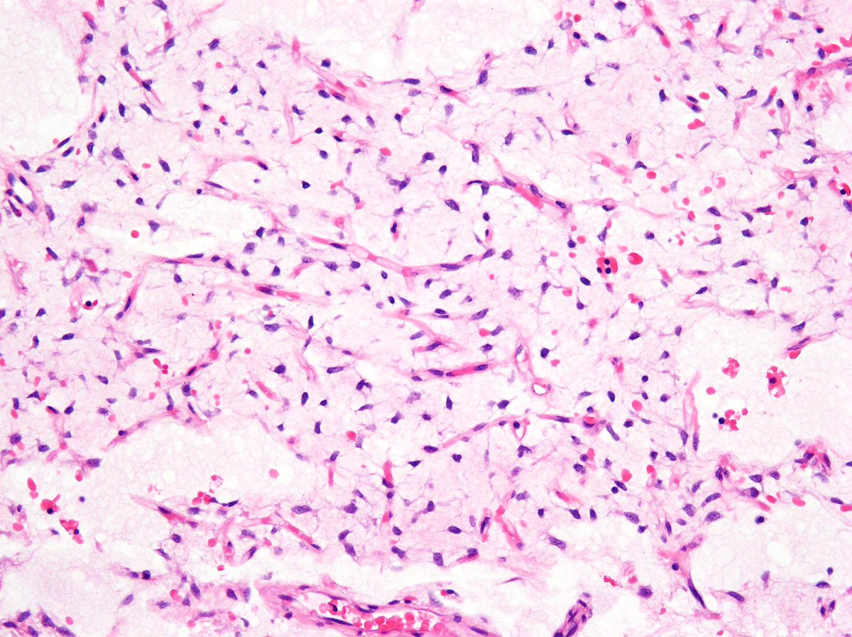 Charlie Herndon tweet media