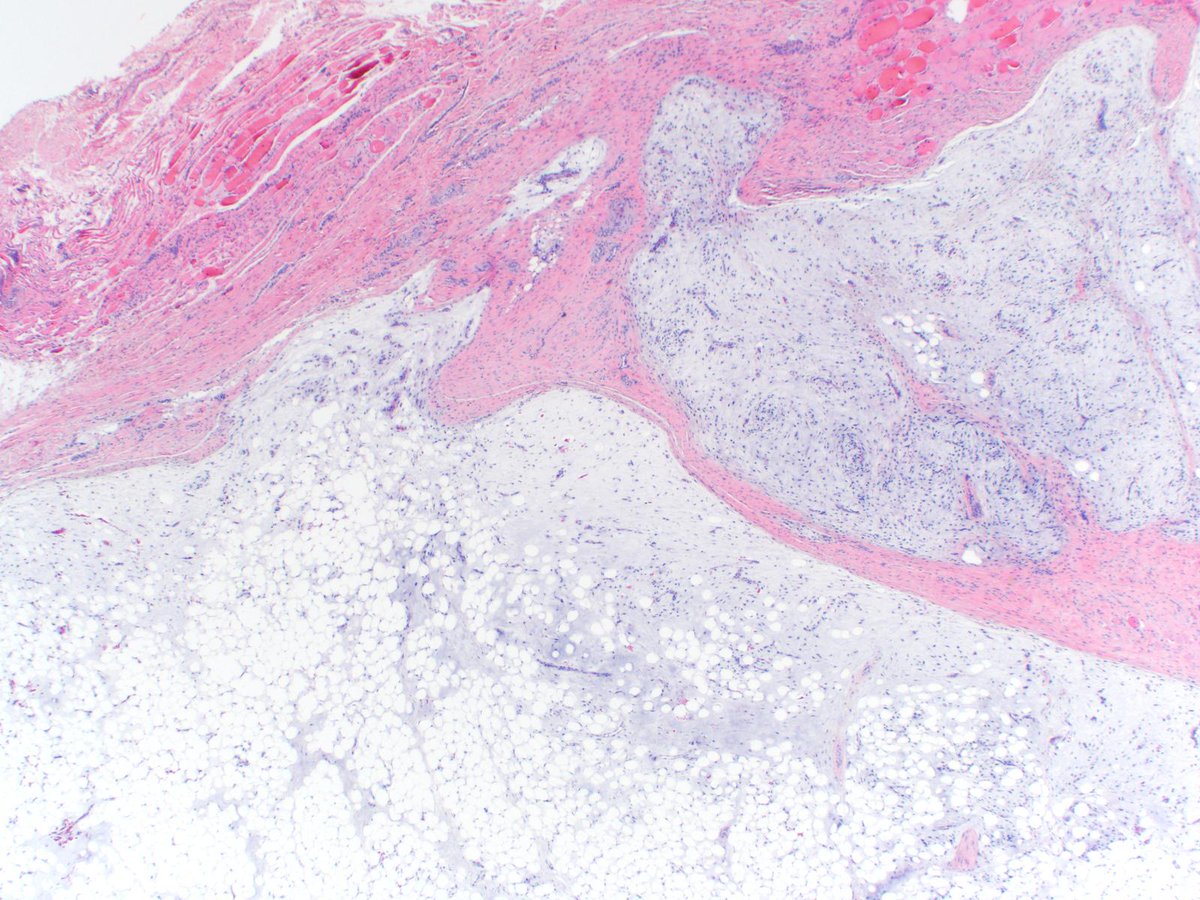 Charlie Herndon tweet media