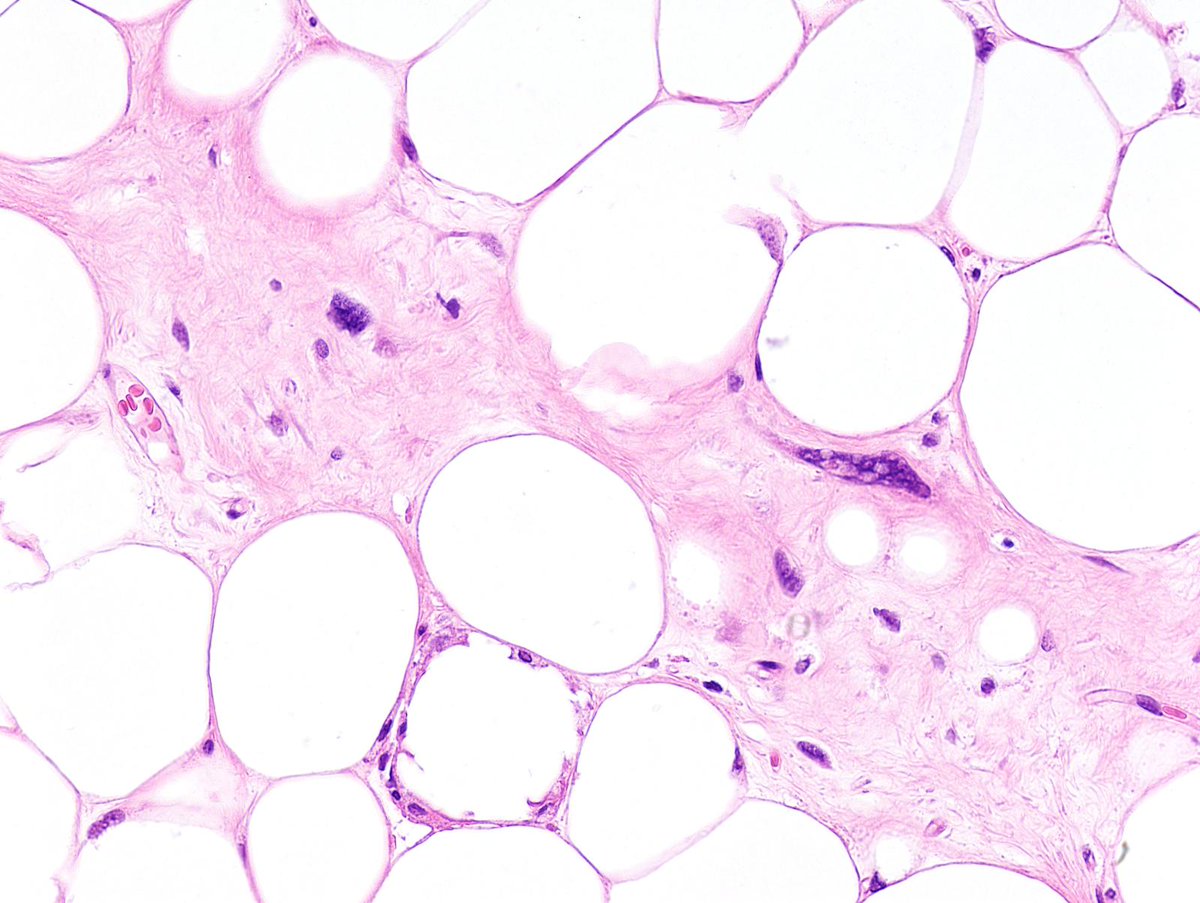 Charlie Herndon tweet media