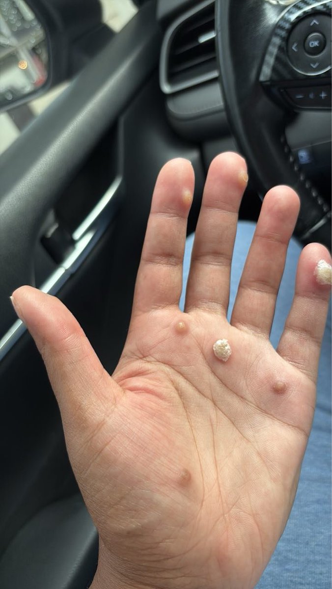 Mastering the Differential 🩺 tweet media